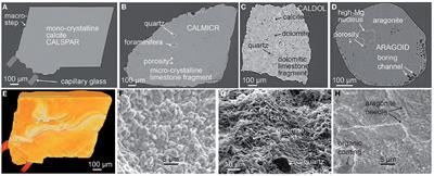 Dissolution rate variability at carbonate surfaces: 4D X-ray micro-tomography and stochastic modeling investigations